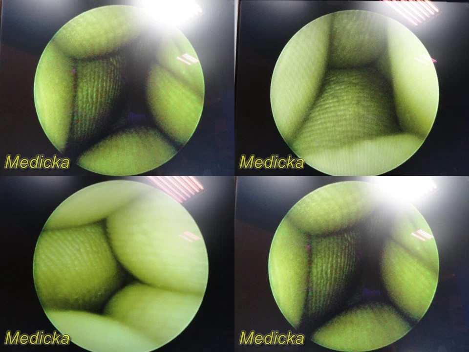 Telescopio Operativo Circon ACMI Olympus M3-12 EE. UU. Elite System M3, 12° ~ 28441 Foto 2 de 4