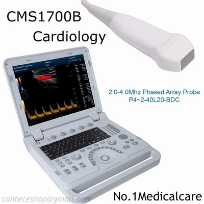 CONTEC Color Doppler Ultrasound Scanner Phased Array Probe Cardiology VET