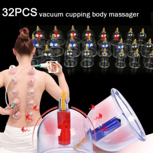 Schröpfen-Set für Vakuum Massage mit 32tlg Schröpfgläser Rohr Cupping Schröpfset - Afbeelding 1 van 12