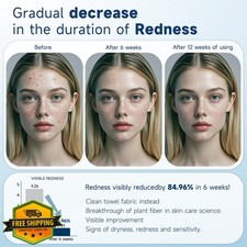 100ct Face Towels 10x12" Disposable Thick Soft Absorbent Makeup Remover Wipes