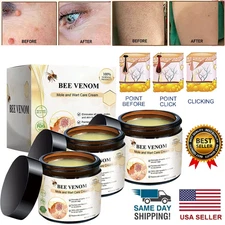 Bee Venom Skin Tag Removal Treatment Cream Body Care Mole Corn Wart Remover