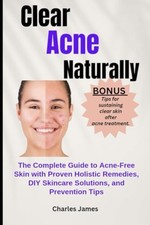 Clear Acne Naturally The Complete Guide to Acne-Free Sk - NEW CHARLES. JAMES 20