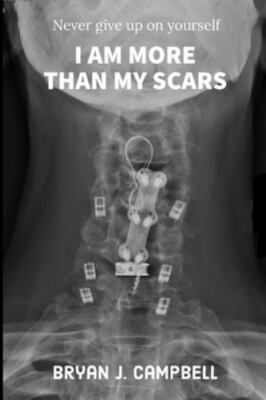 I Am More Than My Scars: Never Give Up On Yourself by
