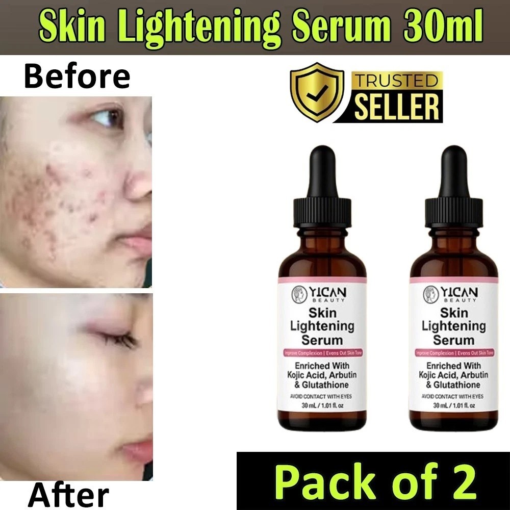 Skin Whitening Serum - Lighten Body Blemishes, Brighten Skin Tone, Protect Skin