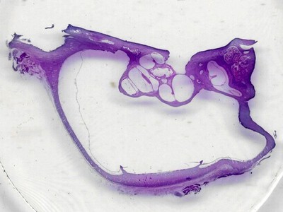 Cochlea, Mammal; Showing Inner Ear and Organ of Corti; Longitudinal Section; H&E