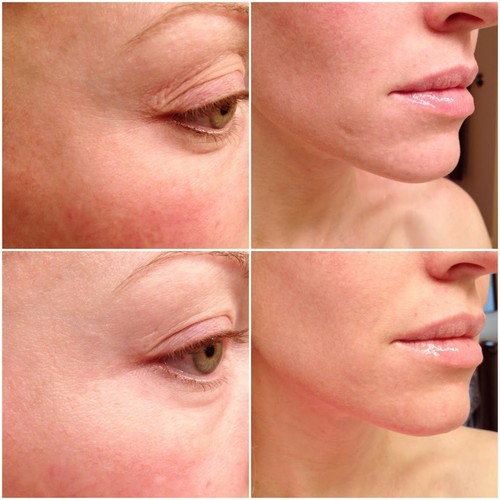 Vitamin A - Anti Wrinkle Serum 50ml - Natural Anti-Microbial 1B - Picture 7 of 12