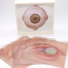 Vtg Schering Ophthalmology Eye Disease Medical Teaching Aid Slide Set Anatomy