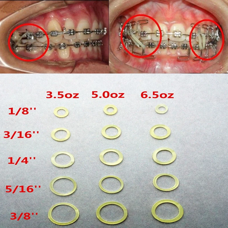 Orthodontic Elastic