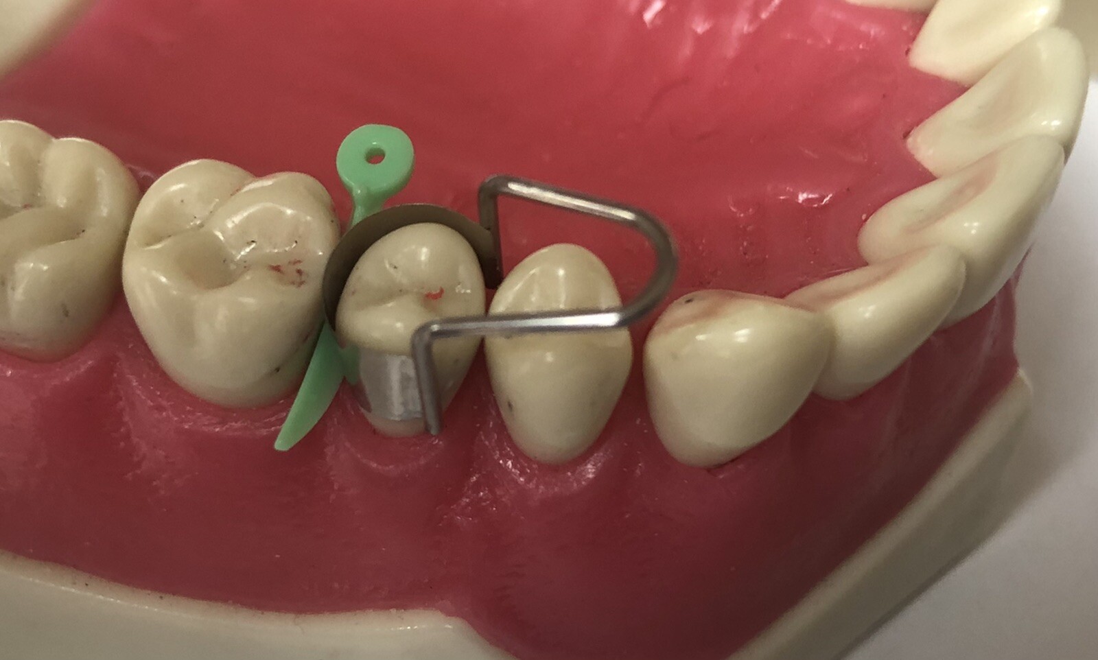 Dental Matrix Bands/ The U Dental Bands.Premolars. eBay