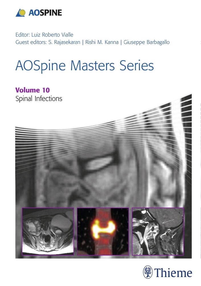 Thumbnail - Aospine Masters Series, Volume 10: Spinal Infections