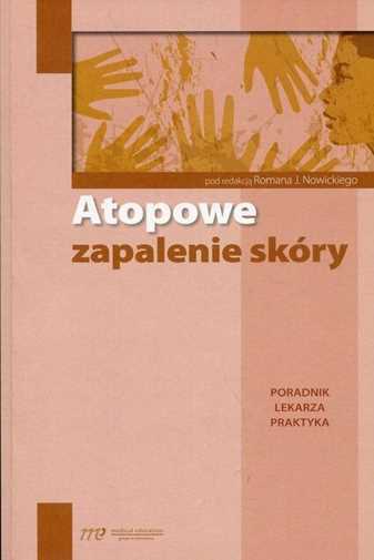 Atopowe Zapalenie Skóry Poradnik Lekarza Praktyka {skory}
