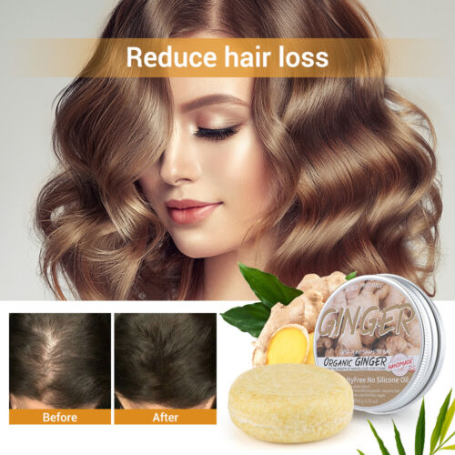 Ginger Hair Growth Shampoo Bar Soap Hair Regrowth Anti Hair Loss Damage  Repair | eBay