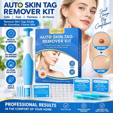 Micro Auto Skin Tag Remover Device Safe Effective Skin Tag Removal Kits Home Use