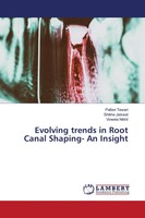 Pallavi Tewari (U. A.) | Evolving Trends In Root Canal Shaping- An Insight