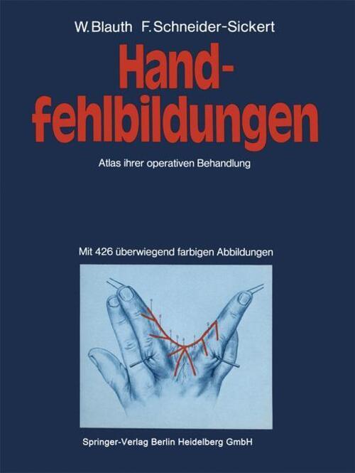 Thumbnail - Handfehlbildungen Atlas Ihrer Operativen Behandlung F.