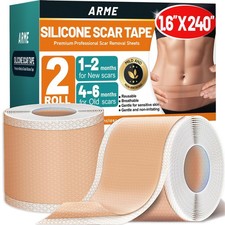 Silicone Scar Tape, 1.6" x 240" Silicone Scar Sheets 2 Rolls-6M , Medical Gra...