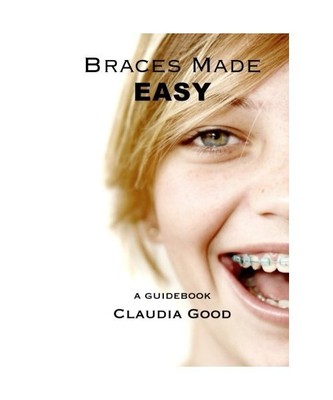 Braces Made Easy: A Guidebook For Braces, Good, Claudia