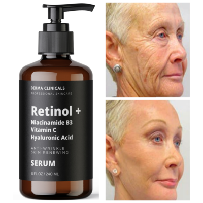 #ad 8oz Retinol Niacinamide Vitamin C Hyaluronic Acid AntiAging Wrinkle SERUM $27.99