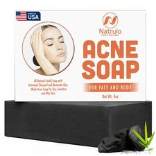 Acne Soap Cleansing Bar for Face & Body – Black Activated Charcoal Soap with Ben