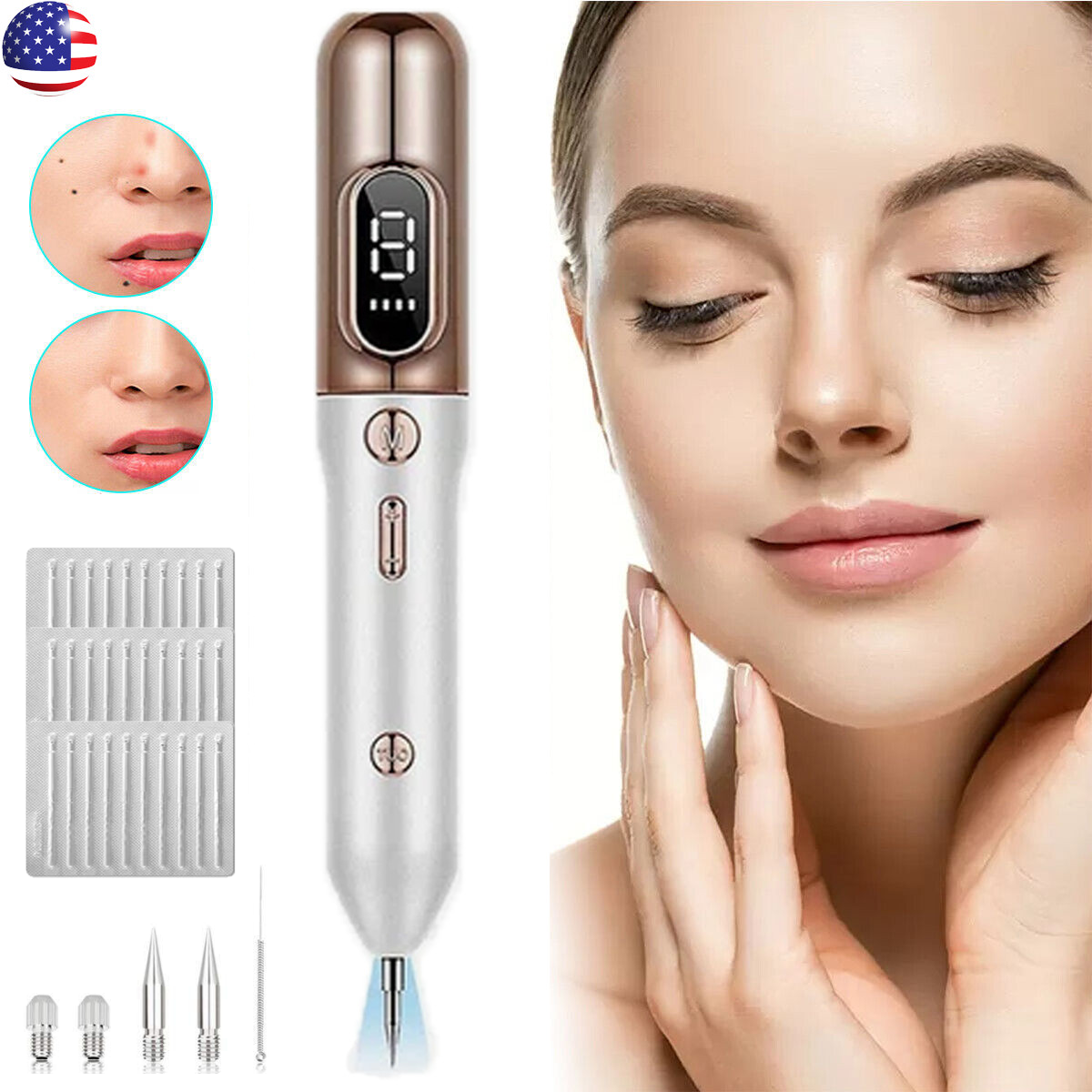 Electric Laser Plasma Mole Removal Pen Dark Spot Remover Skin Wart Tag Tattoo US