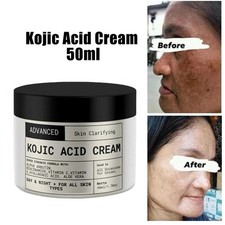 Instant Whitening Cream for Dark Knees Knuckles and Elbows Fast Action Extreme