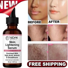 Intimate Area Whitening Serum 30ml   Skin Lightening  Brightening Oil for...