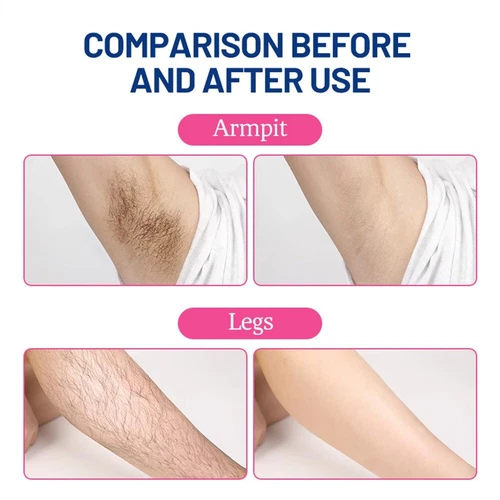 20Pcs/Set Hair Removal Wax Paper Body Facial Whitening Shaving Sticker Women - Picture 3 of 15