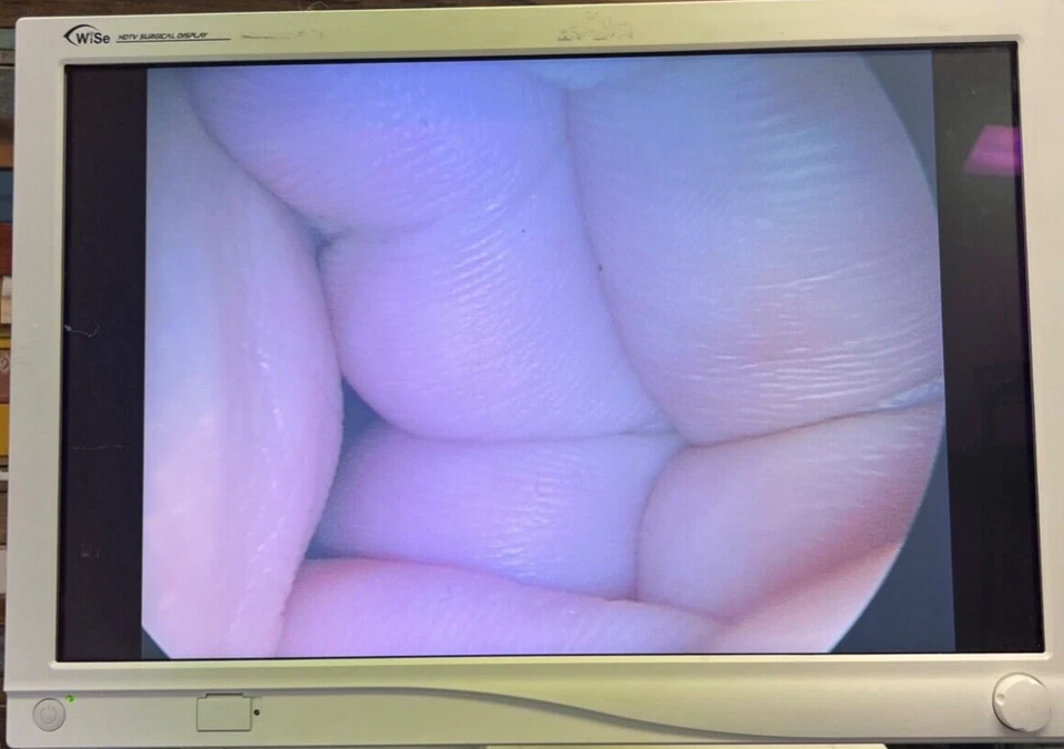 Laparoscopio bariátrico Karl Storz 26003FEA Hopkins II 10mm x 45° x 42cm CA Foto 2 de 4