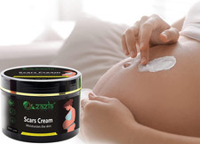 Anti-Stretch Marks Cream Moisturizes Skin Prevents  Reduces Stretch Marks 100gm