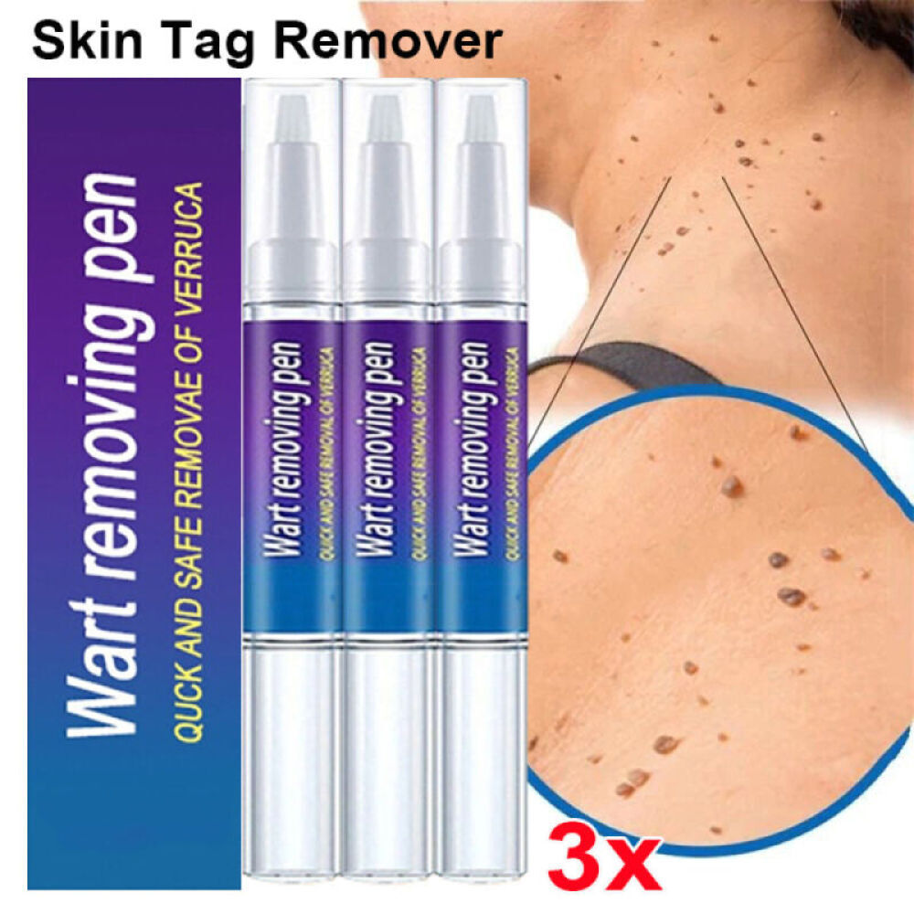 3Stk Wart Entferner Stift Haut Tag Maulwurf Entferner beseitigen Fuß Mais Warzen