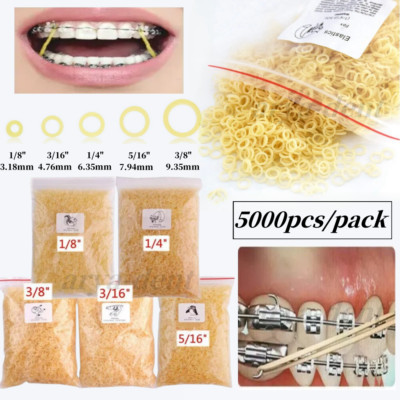 3M Unitek, multifunctionele elastieken medium, 113,4 g, Snorflex (1/8 inch 3,2 mm) Cathy