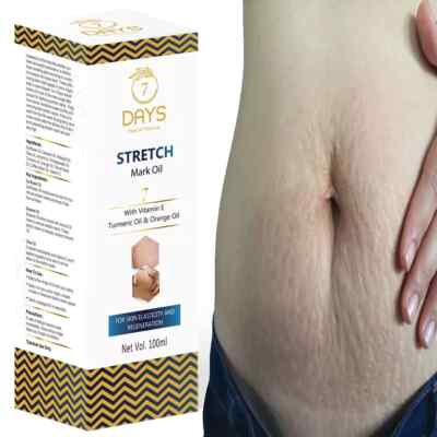 7 Days Stretch Marks Scar removal cream oil