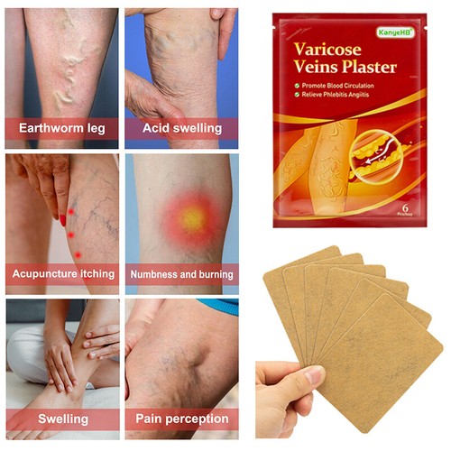 Parche de cuerdas de cramoso 6 piezas Phébitis vasculalit plástico vistos venas venas venas - ♩ - Imagen 6 de 13
