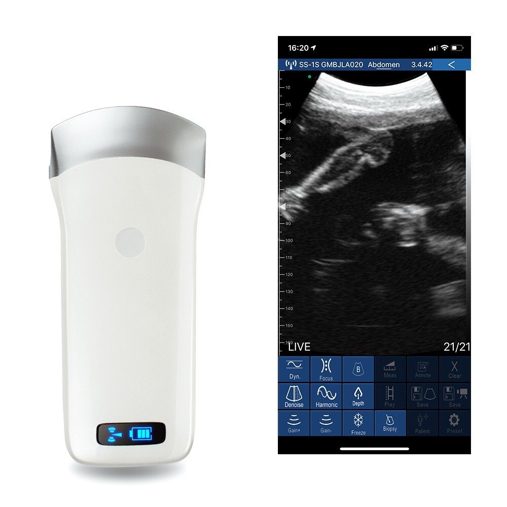 Carejoy Portable WIFI Wireless Ultrasound Scanner Machine + Convex Probe 3.5Mhz