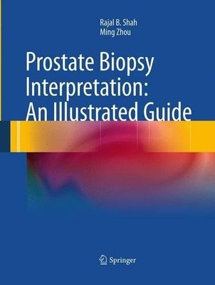 Prostate Biopsy Interpretation: An Illustrated Guide - 9783662520093