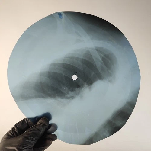 BLACK SABBATH BLACK SABBATH X-Ray USSR Record Roentgen Bone Ribs Music Vinyl