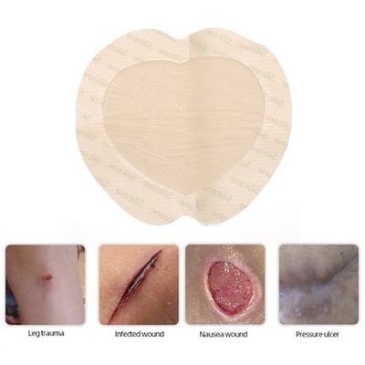 #ad 1pc Silicone Wound Patch Bedsore Dressing Patch for Pressure Ulcer; $6.78