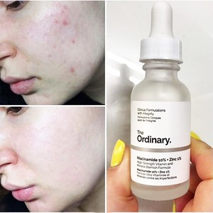 ordinary face serum