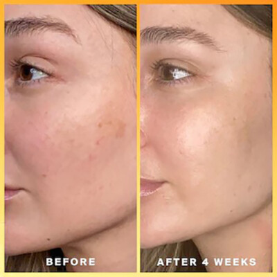 brightening serum- kojic acid & glutathione reviews Glutathione Kojic Acid Vitamin C Serum for Bright Skin KOJIC ACID Skin Whitening Lightening