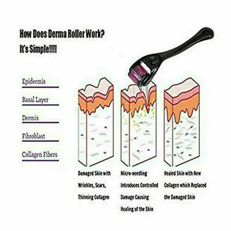 Derma Roller 540 Nadeln Roller für Haarwachstum Hautpflege Körper Behandlung - Bild 4 von 4