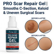 Pro Scar Repair Gel Smooths C-Section, Keloid Uneven Surgical Scars