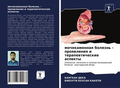 mochekamennaq bolezn' - proqwleniq i terapewticheskie aspekty Kangkan Deka