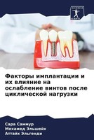 Sara Sammur (U. A.) | Faktory Implantacii I Ih Wliqnie Na Oslablenie Wintow...