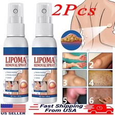 2PCS Lipomheilung Reduction Spray, Instant LumpFree Lipoma Removal Spray USA Hot