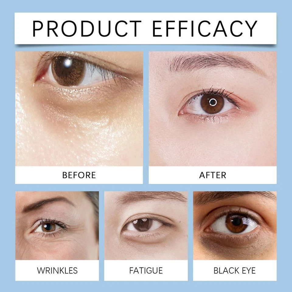 1-6X Firming Eye Serum for Rapid Reduces Under-Eye Bags, Wrinkles, Dark Circles - Image 3 of 4