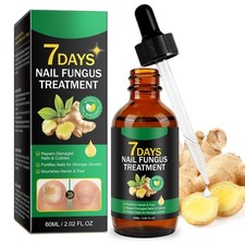 7 Days Nail Fungus Treatment   Extra Strength Repair for Nails  Cuticles 60ML