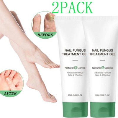 Nutraboost Fungus Nail Gel, Treatment Nail Fungus, Fungus Cream (1-5PCS)