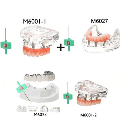Dental Implant Model Dental Simulator Dental Teeth Model Upper&Lower Overdenture