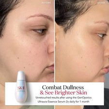 SK-II Dark Circles Anti-Aging Products for sale | eBay
