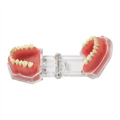 Multiple Types Dental Teeth Model Ortho Implant Practice Teaching Demo Model - Picture 245 of 276